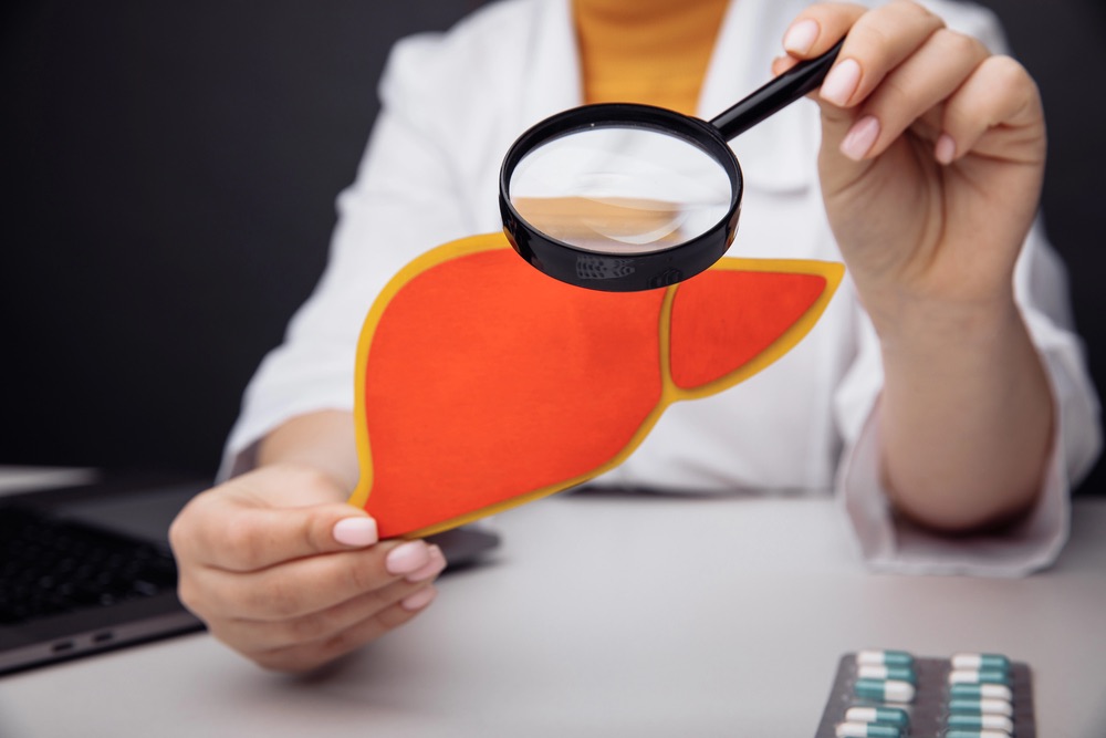 Prevencia nealkoholovej steatózy pečene zdravou stravou: Diéta podľa nutričnej špecialistky